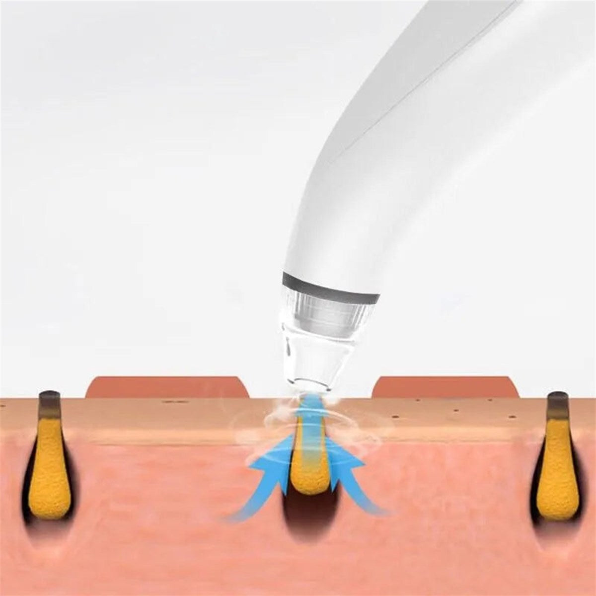 Gentle suction does the work.